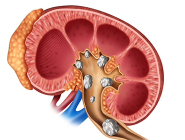 homoeopathy treatment for liver cirrhosis in Pammal
